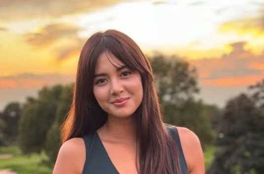 Waduh! Aurelie Moeremans Alami Penyusutan Otak Imbas Pernah Kecelakaan Mobil