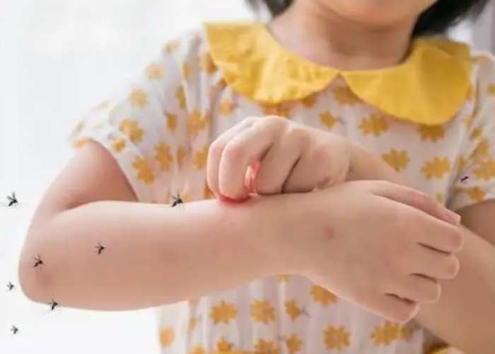 Waspada! Kasus DBD di Indonesia Melonjak Tajam, Kemenkes: Kasus Kematian Mayoritas Anak Usia 5 Tahun