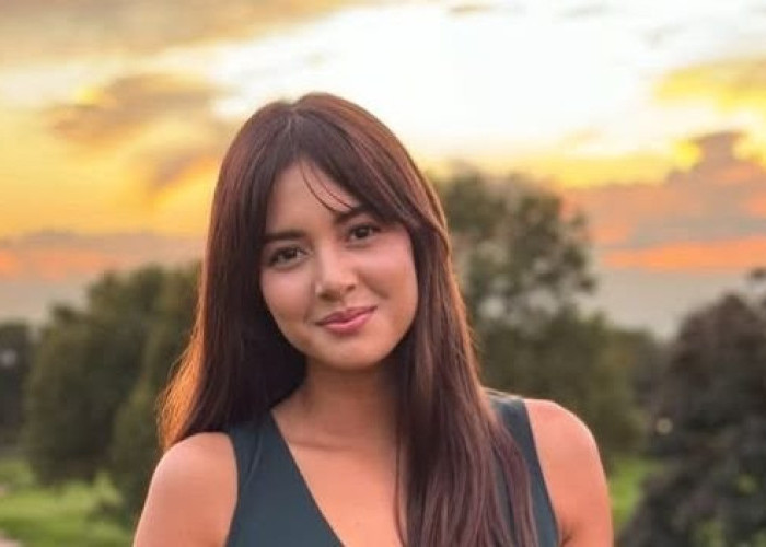 Waduh! Aurelie Moeremans Alami Penyusutan Otak Imbas Pernah Kecelakaan Mobil