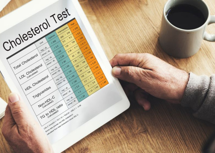 Waspada! Makanan Sehari-hari Ini Ternyata Tinggi Kolestrol